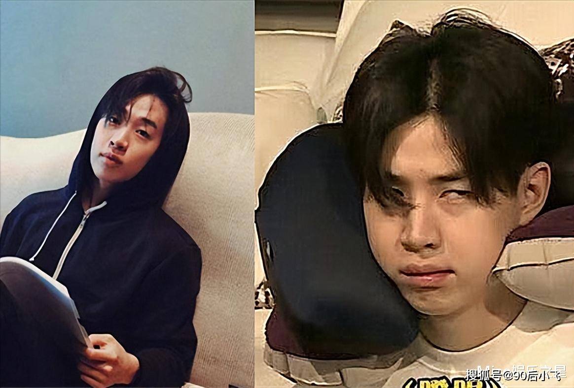 太逗!明星刘宪华被经纪人骗去拔智齿,一顿操作下来肿得像蜜蜂狗