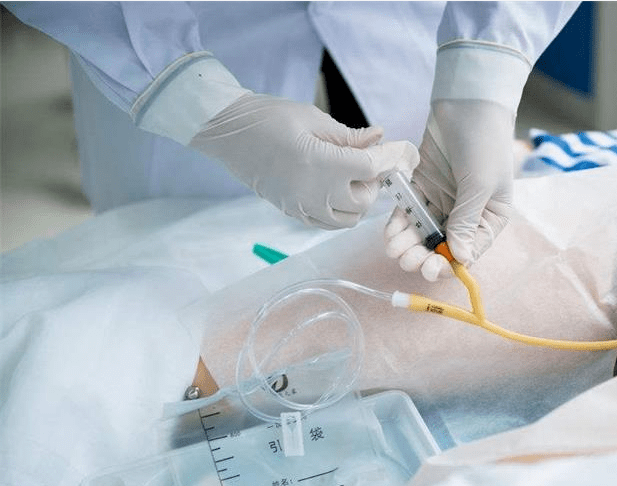 长期甚至终身留置导尿管的患者需要长期,定期的更换尿管及尿袋,且多为