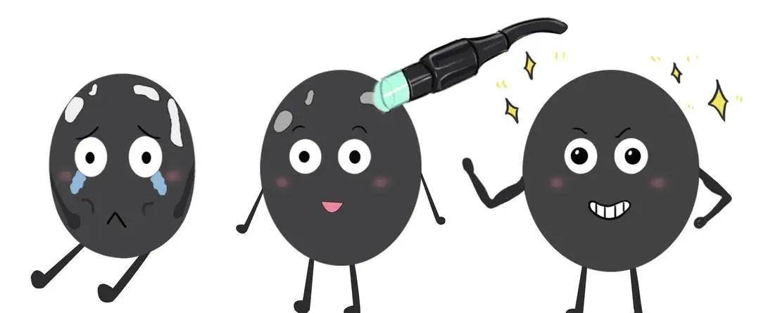 308nm准分子激光治疗白癜风,你所关心的问题都在这_白斑_患者_皮肤