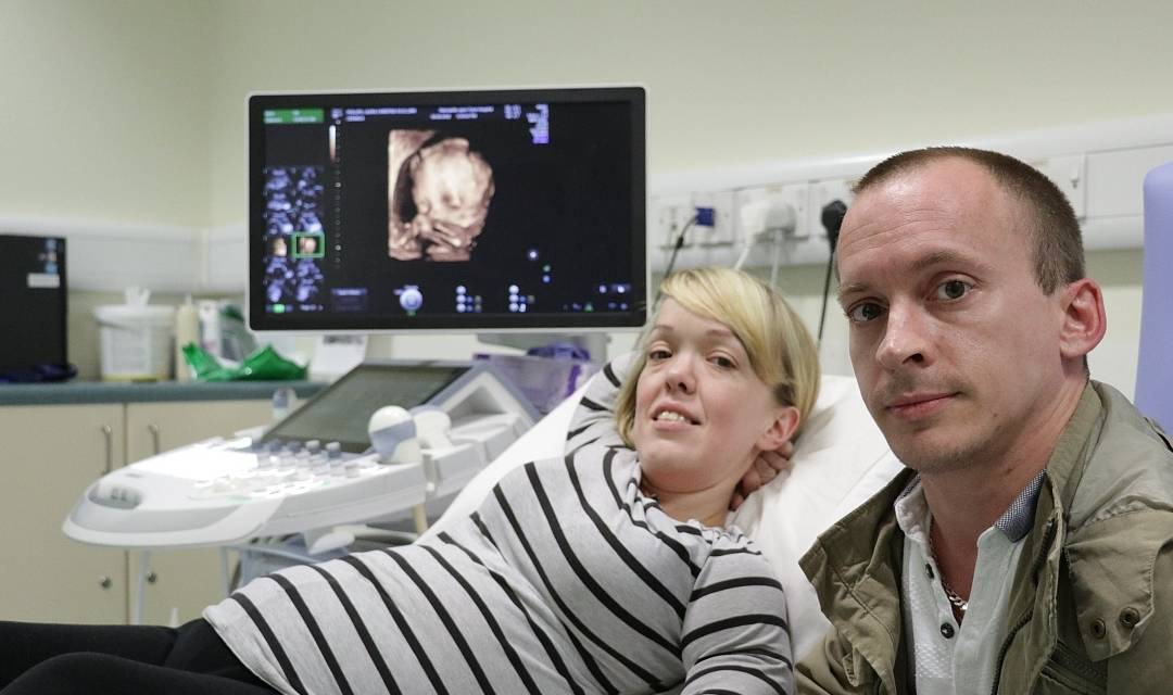 怀孕11~14周做nt检查,通过看胎儿颈部透明带的厚度来诊断婴幼儿染色体