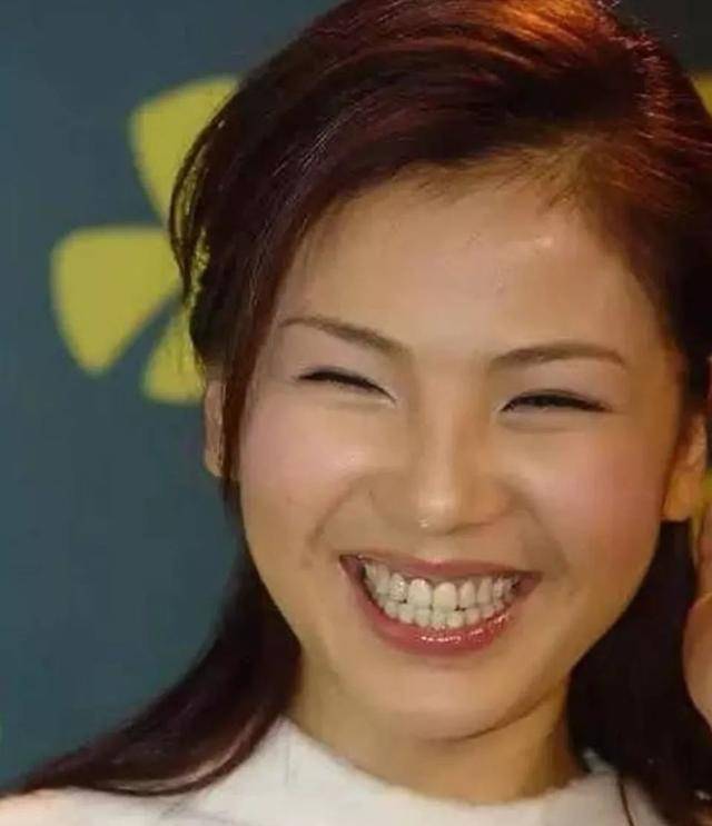 戚薇的"钻石牙"太闪亮了!