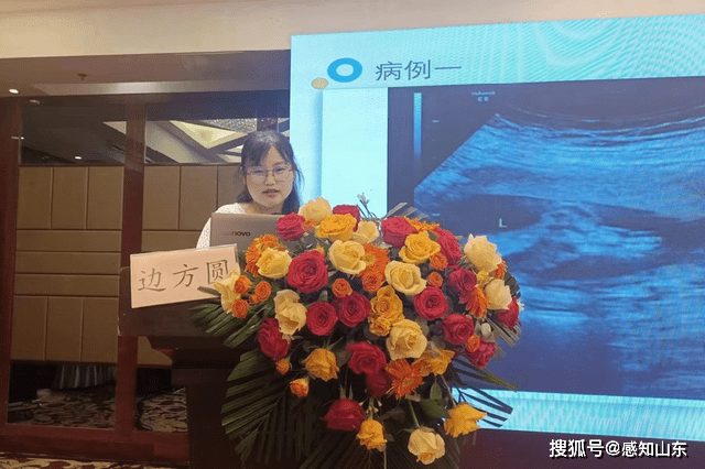 院于婷芹主任,边方圆副主任医师,叶春秀副主任医师分别在胎儿产前超声