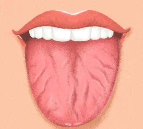 舌中有裂缝是什么原因呢?_舌头_情况_裂痕