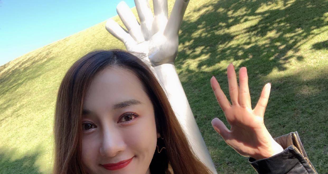 她曾被狗咬伤导致毁容,缝20多针微整5次,如今36岁却成这样_李依晓