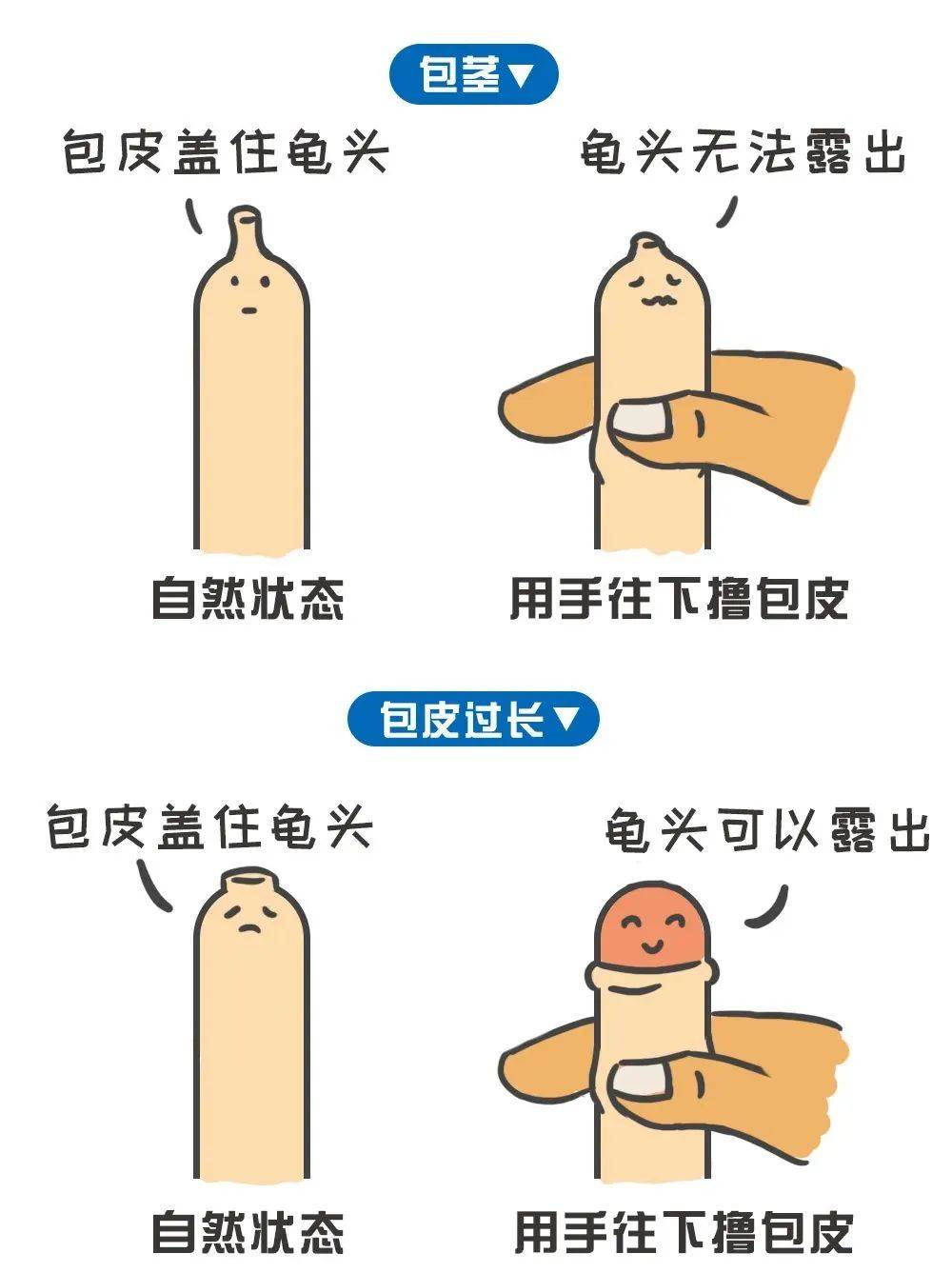 家里有男孩的一定不要轻易做包皮手术,伤害发展中的大脑(下)_孩子