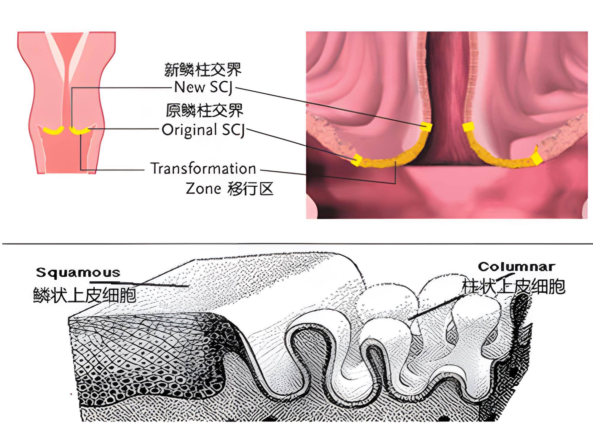 揭开几大妇科骗局,看看你信了几个_宫颈_苏女士_医生