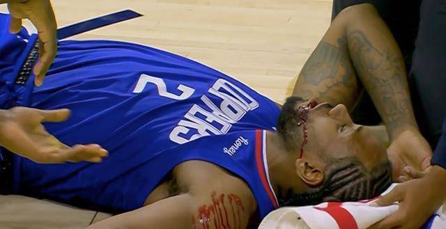 伊巴卡铁肘误伤小卡:被击中脸部变形,血流如注_莱昂纳德_快船_上半场