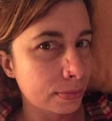 狗狗一直扑女子身上嗅她的鼻子,反常行为救下主人生命 狗狗一直扑女子身上嗅她的鼻子,反常行为救下主人生命