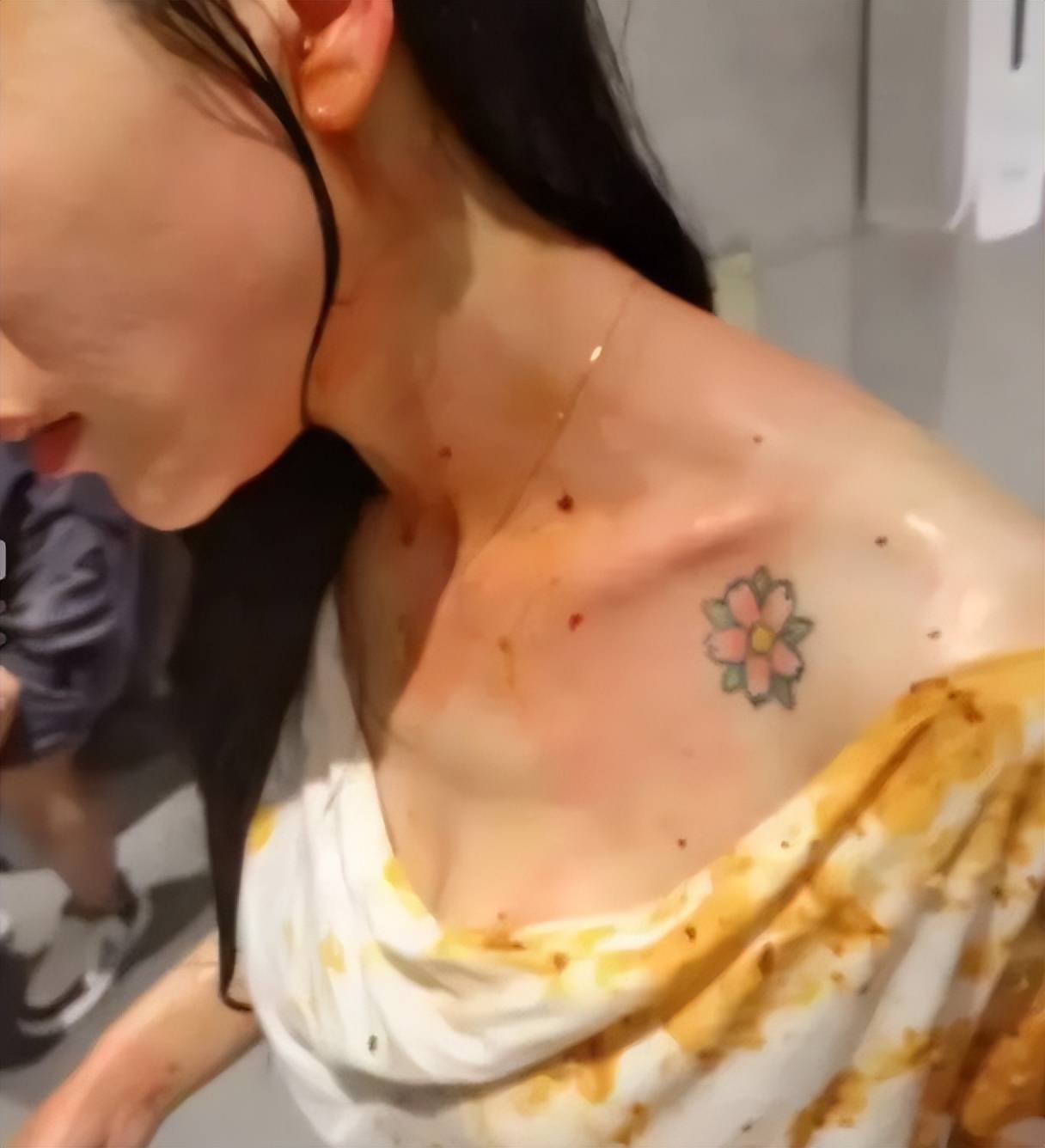 痛心!她2年遭受16次家暴,被泼滚烫砂锅,被刀砍,被开膛破肚