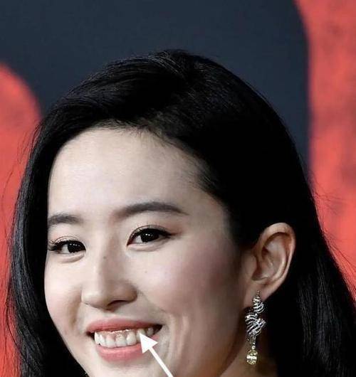 虽然刘亦菲内眦赘皮,露龈笑,溜肩……但她就是美得没有道理_时候_缺陷