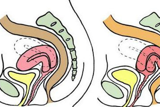 子宫_女性_影响