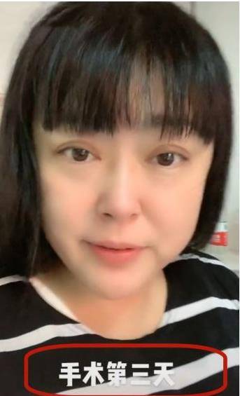 知名艺人李菁菁自曝患病!