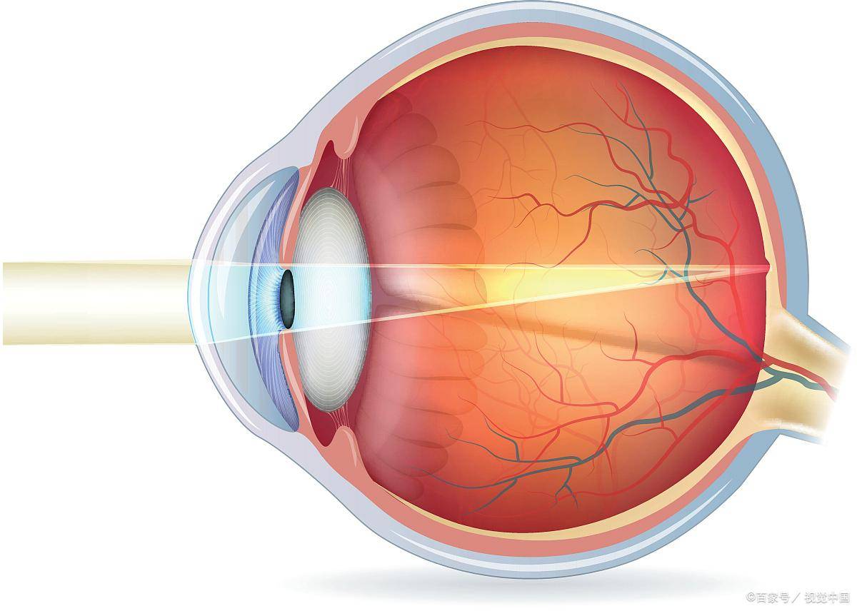 下文就给大家介绍一下散光以及散光的矫正方法_进行_角膜_检查