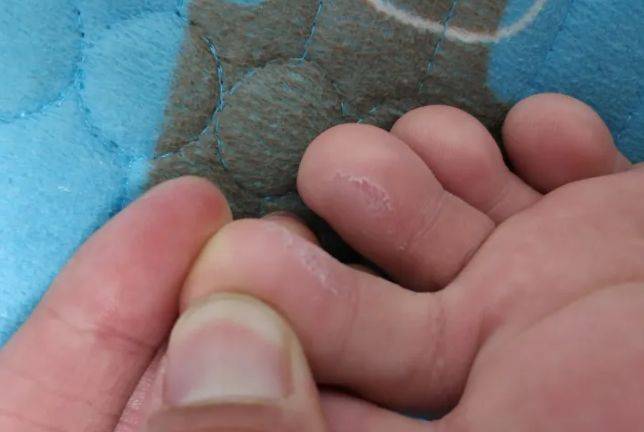 引起脚气的菌一般有:红色毛癣菌,丝状真菌,念珠菌等.