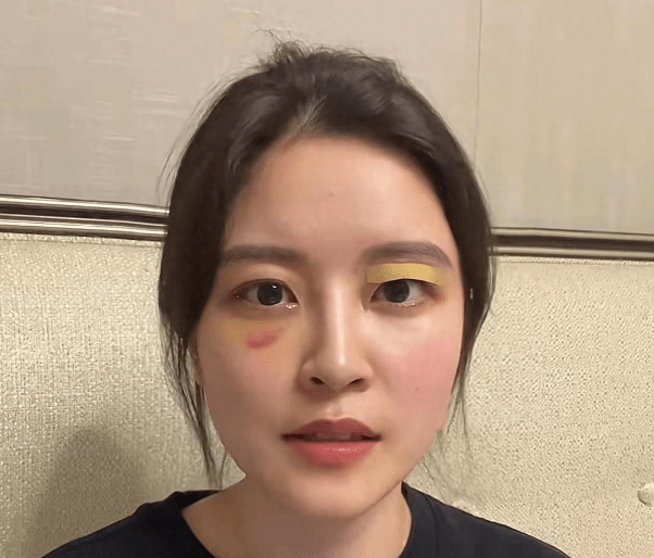 曝好声音学员发声后被打,鼻青脸肿申请警方保护,被