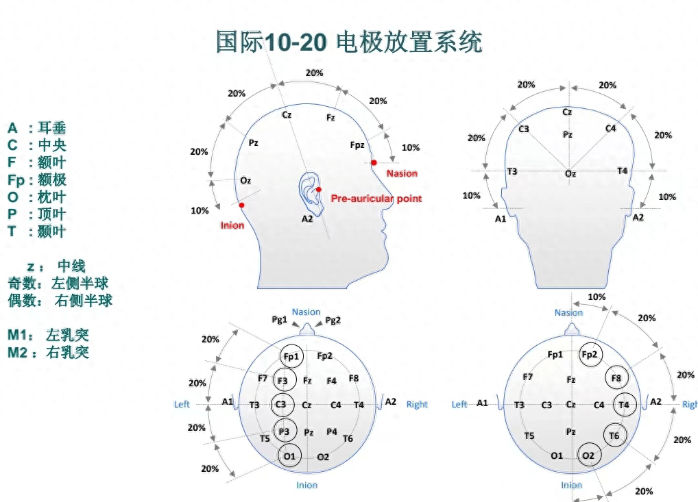 根据国际脑电图学会10-20系统电极放置法放置记录电极和参考电极