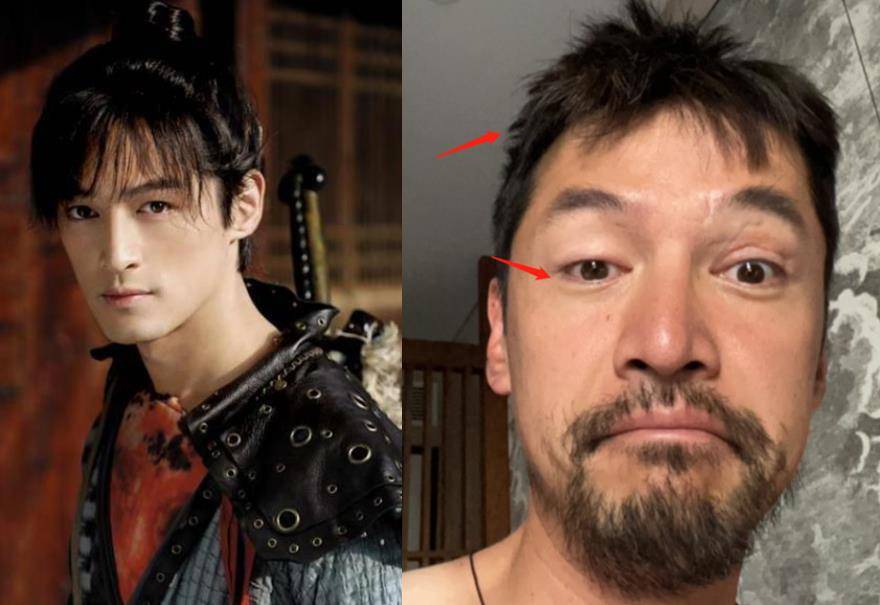 胡歌凌晨晒疤痕照,称对不起很多人,眼睛红肿乱剪头发,疑患抑郁_车祸