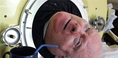 亚历山大一出生的时候原本也是健健康康的,但是在1952年,也就是在他6