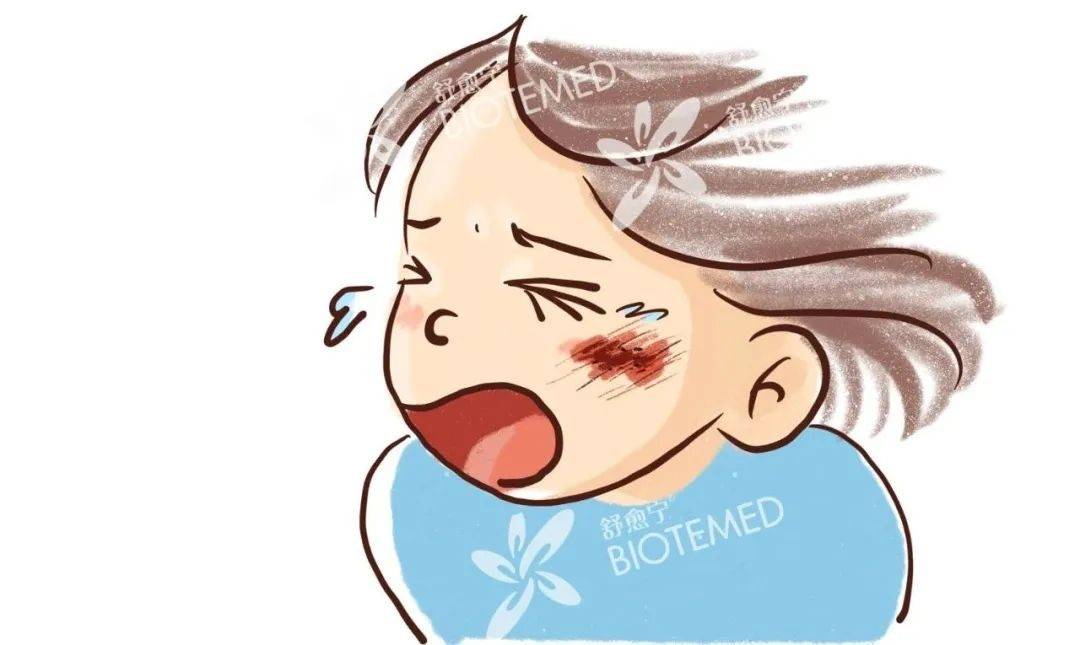 舒愈宁丨宝宝面部擦伤,不留疤的秘密!(漫画图解版)_伤口_消毒_创面