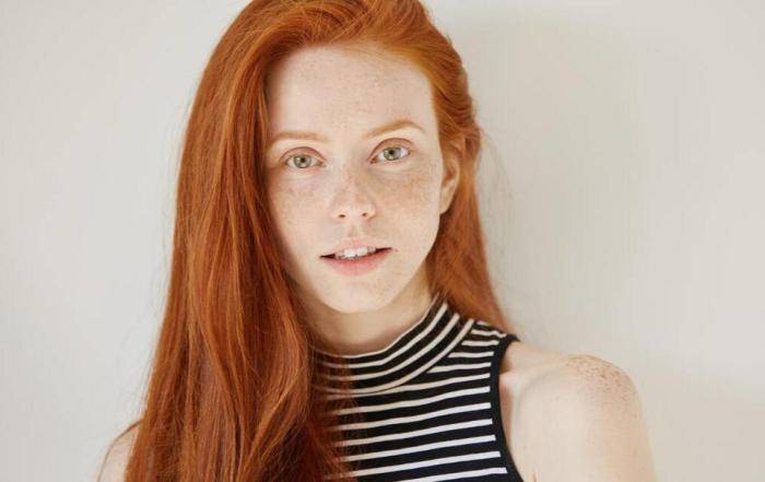 祛斑秘籍:远想生物&伊肤泉让你摆脱"斑"女郎称号_问题_斑点_再生