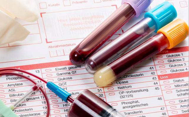 血液检查报告单血常规图片