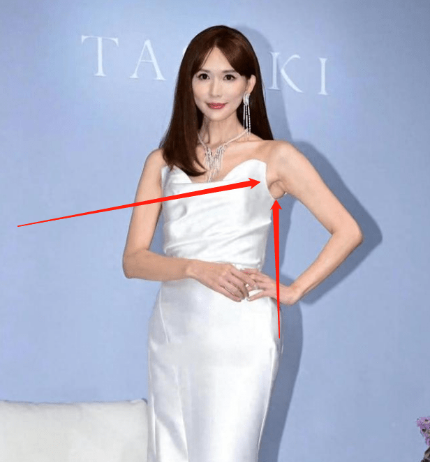 林志玲疑退圈后近照曝光,穿吊带勒出副乳,脸憔悴皮包骨引热议_网友