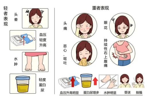 医维他|远离孕期"隐藏杀手",一篇讲明白"妊娠期高