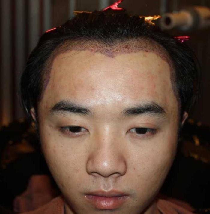 整容,姨化,疯魔,华晨宇这几年到底怎么了?_网友_操作_视频