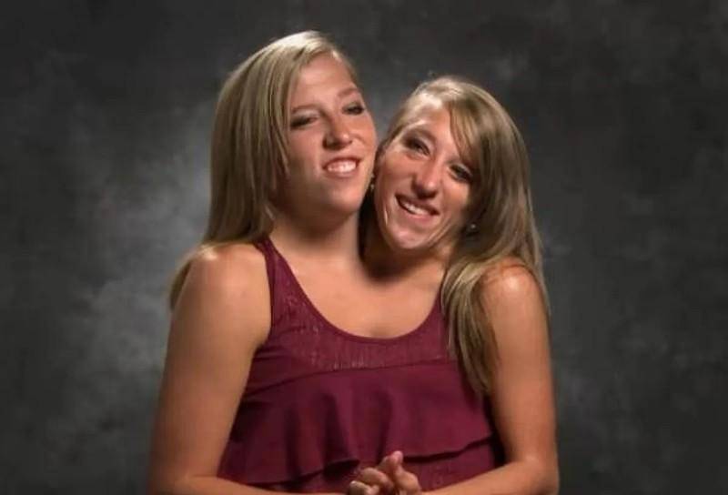 美国连体姐妹:共用一个身体,拿到驾照当上老师,31岁渴望结婚_塞尔