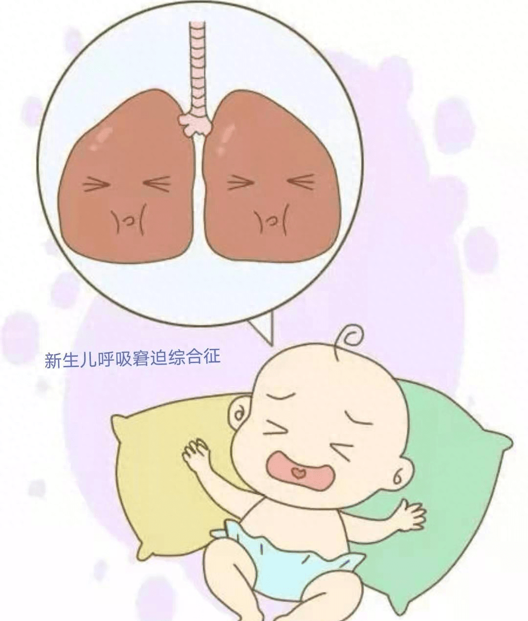 新生儿呼吸窘迫综合征的x线表现及治疗,这里全说明白了_肺部_肺泡