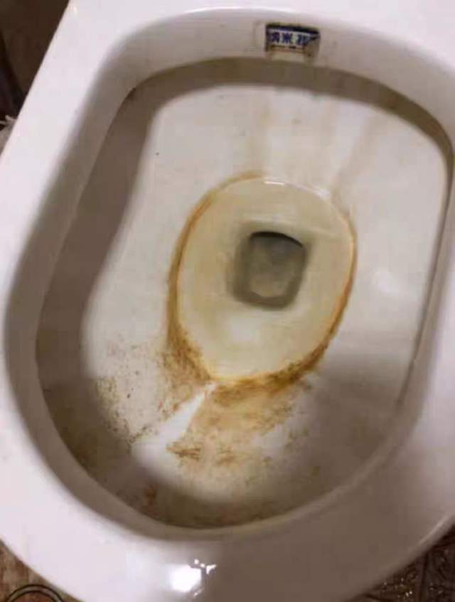 马桶清洁教程:马桶厚厚的尿垢怎么去除?_尿碱_小苏打_水垢