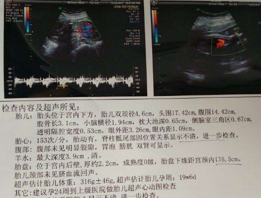 孕16周男宝宝b超图片图片