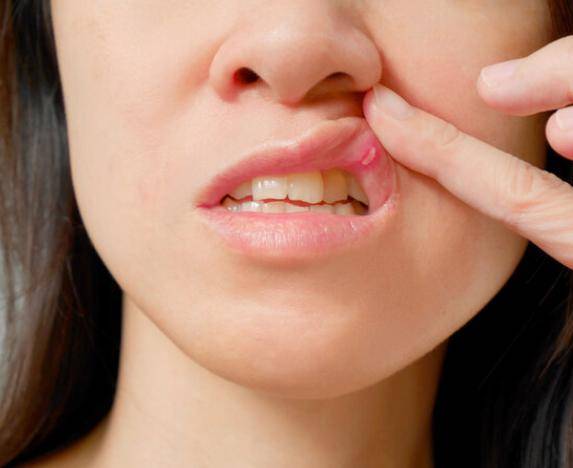 体内有癌,嘴先知?提醒:若口腔有5个迹象,建议尽早做筛查