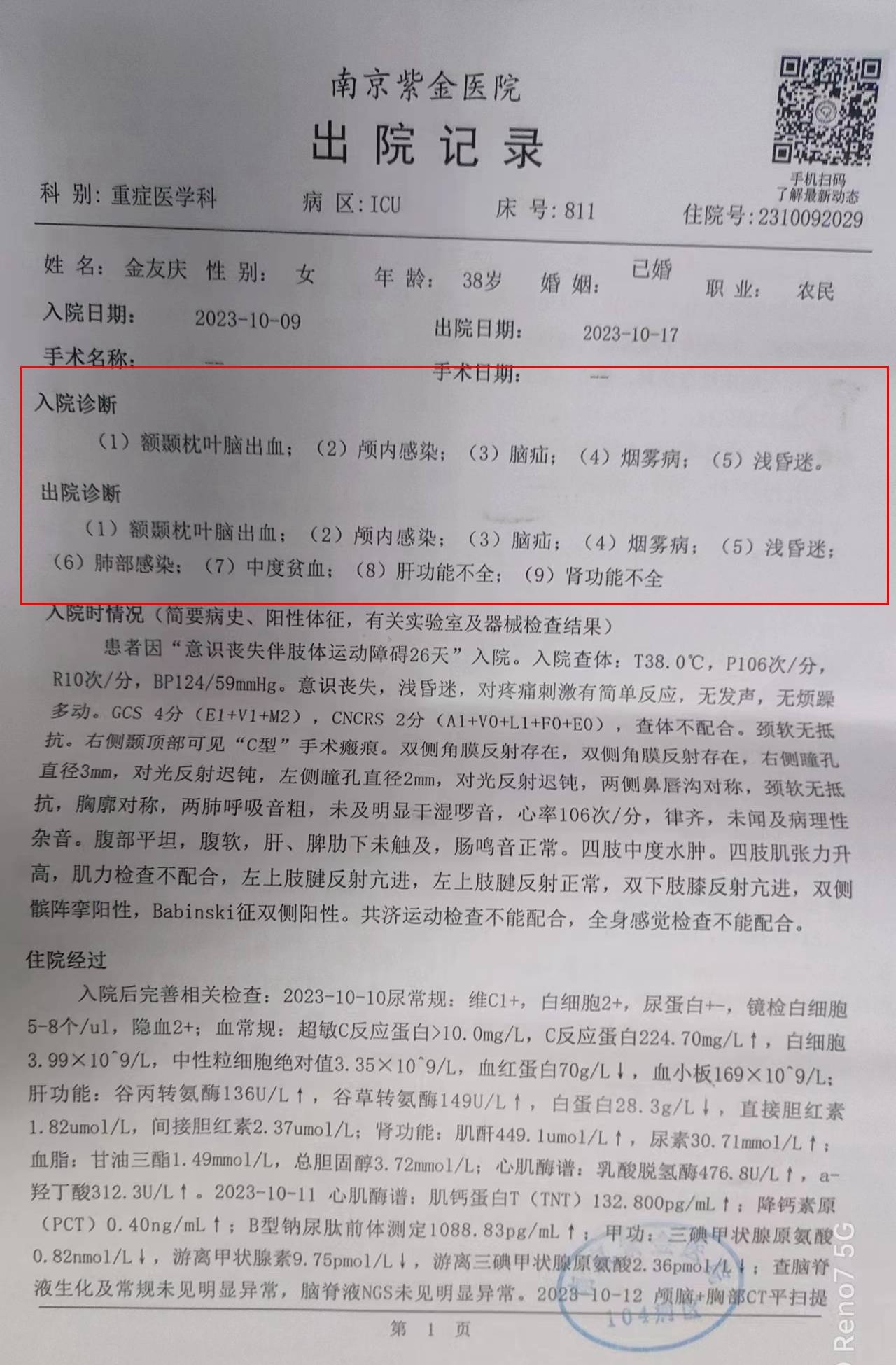 妻子不幸突发脑出血,已在icu住院一个多月,后续治疗急需大家的爱心