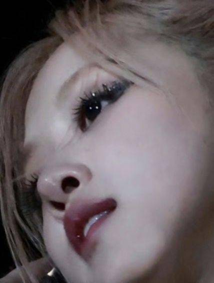 朴彩英近照眉骨鼻子变畸被质疑填充过度,面部僵硬遭吐