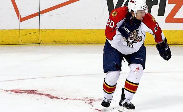 英国冰球运动员意外被对手冰刀割喉身亡!