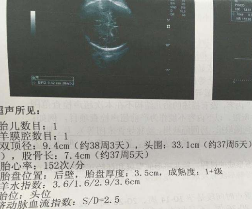 怀男孩的B超单图片图片