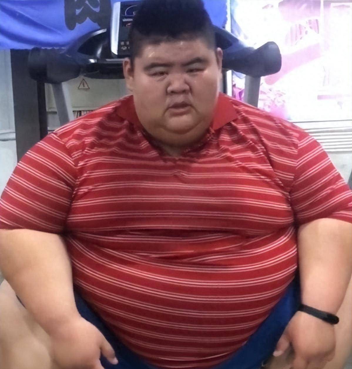中国首胖王浩楠,为爱暴瘦480斤,成名后和娇妻离婚,网友:飘了_减肥