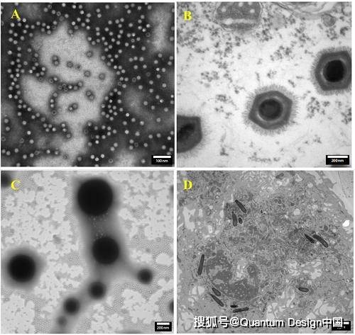 b 拟菌病毒 c 脂质体 d 成纤维细胞与细菌传统高压透射电镜本身就会