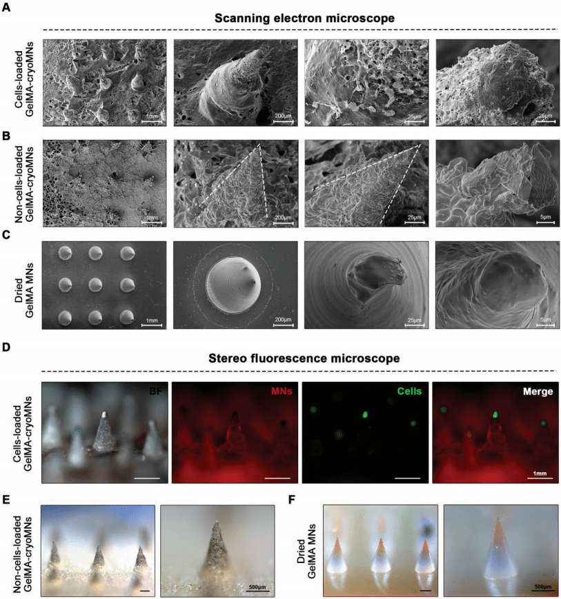 工程和再生领域应用:负载毛囊类器官的冷冻微针_results_研究_凝胶