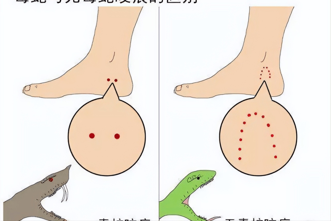 蚂蟥咬人图片图片