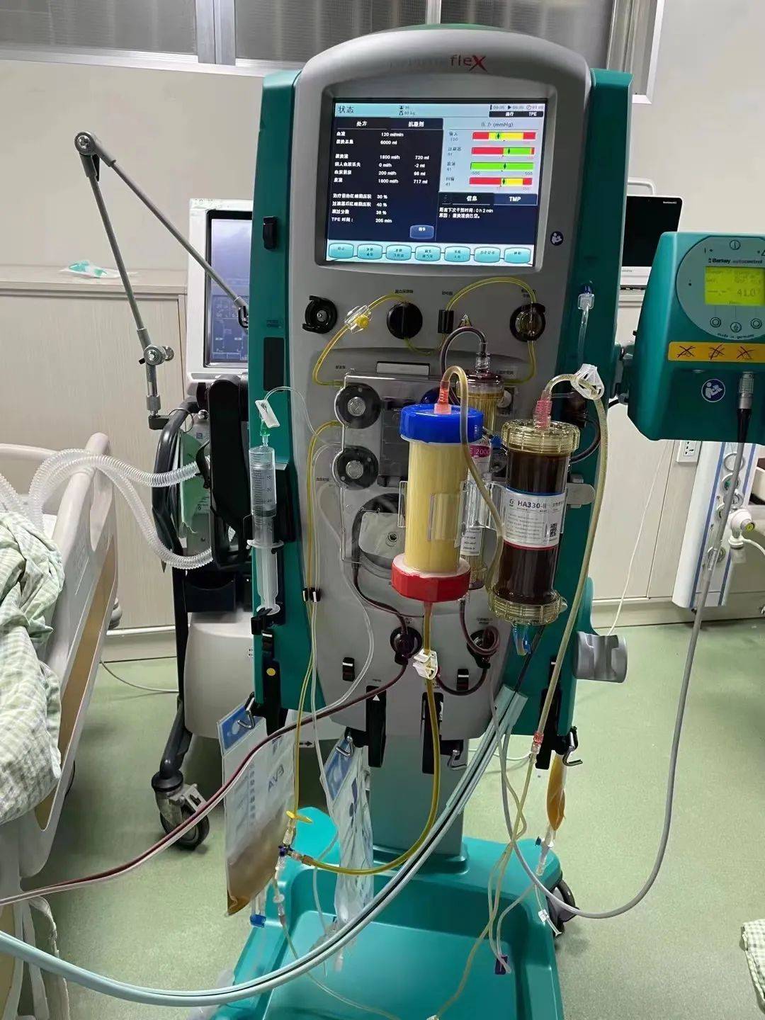 重症肾脏及替代治疗:床旁血液净化术,持续性血液净化术(crrt),血液灌