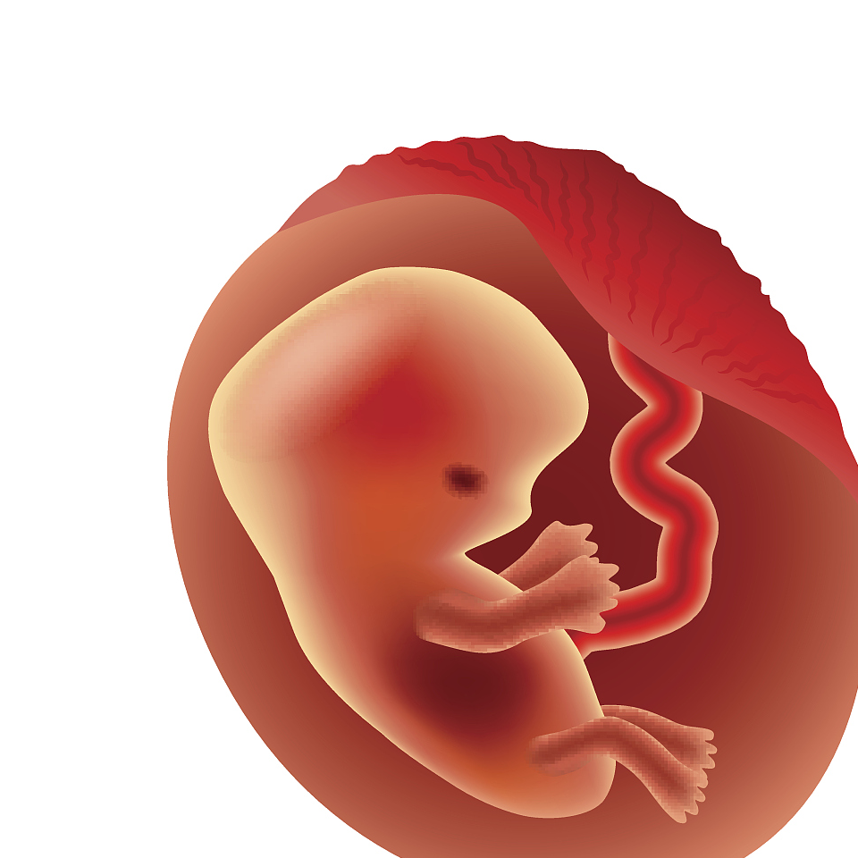 孕8周孕囊大小图片