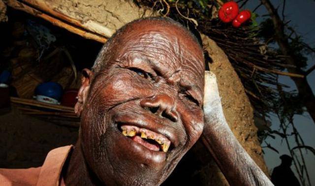 患麻风病不能当国王,为什么此人当了国王,还战胜了强大的敌国_鲍德温