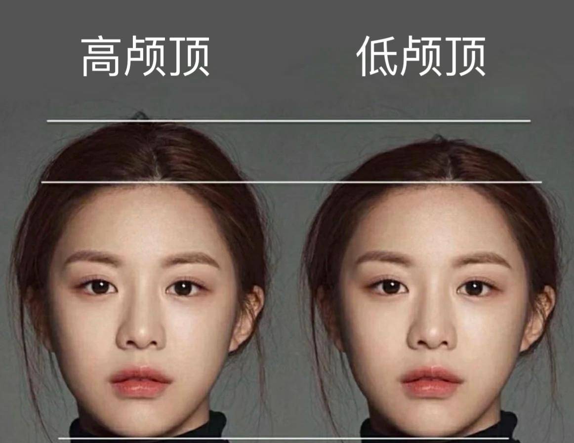 追高颅顶,却遭遇"噩梦",美妆博主补完头顶后头发掉