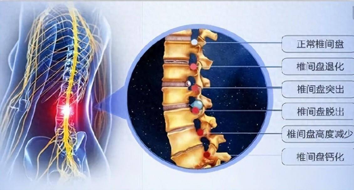 【名院名医】一文带您了解脊髓脊柱疾病!必看