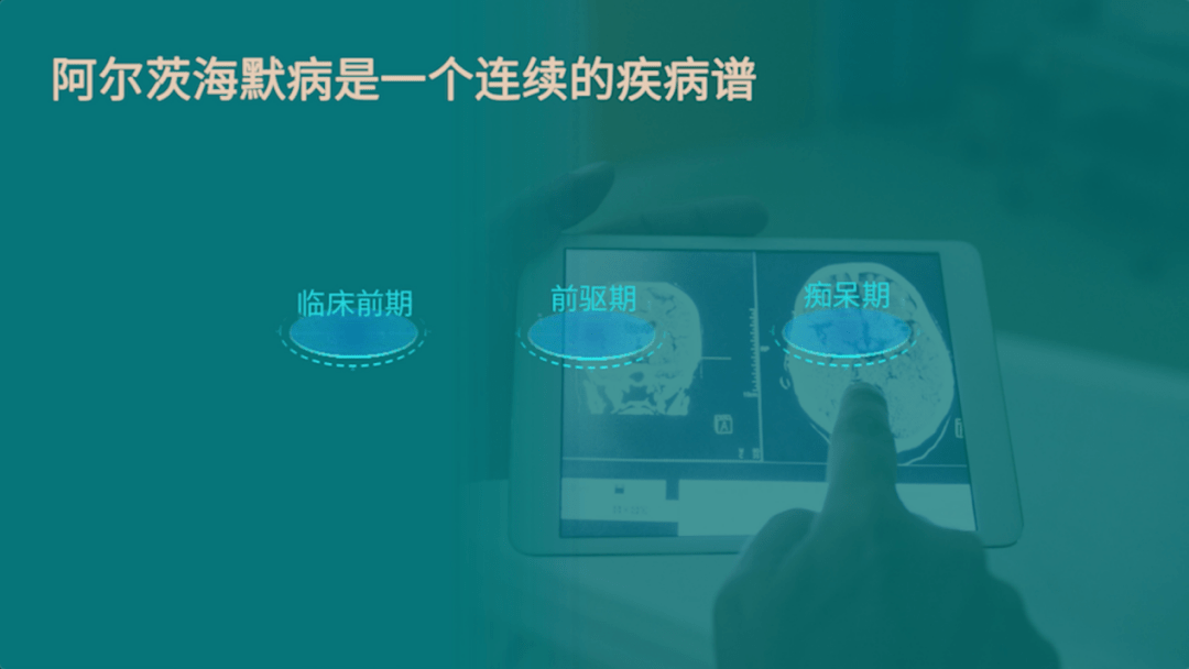 天津醫科大學總醫院張楠:阿爾茨海默病需要早診斷早治