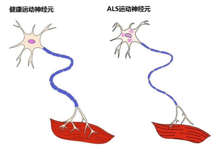 下肢剪刀状图片图片