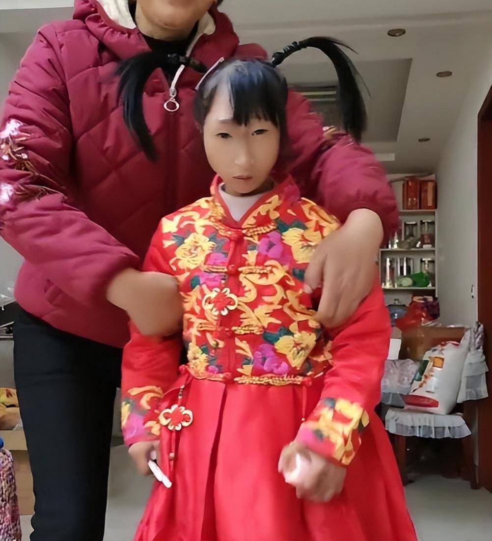 34岁"袖珍女孩"小晓性格暴躁,掌掴母亲说父亲,网友:耗子二姑_父母