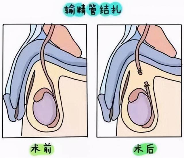 中国第一批上环的女性